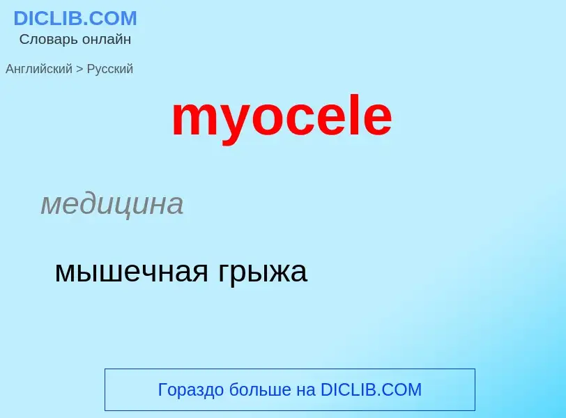 ¿Cómo se dice myocele en Ruso? Traducción de &#39myocele&#39 al Ruso