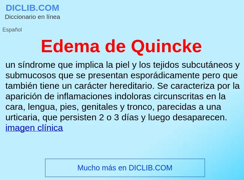 ¿Qué es Edema de Quincke? - significado y definición