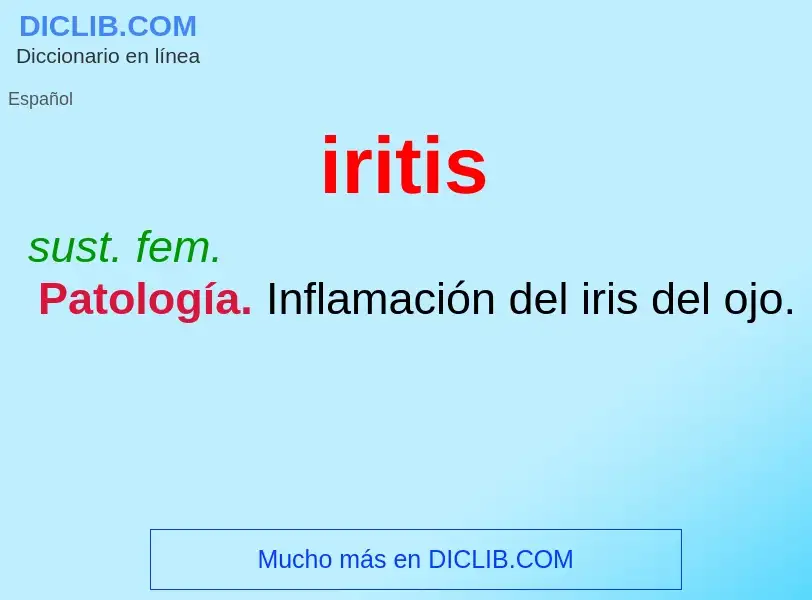 ¿Qué es iritis? - significado y definición