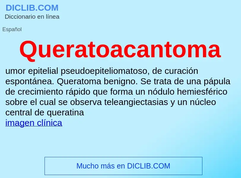 ¿Qué es Queratoacantoma? - significado y definición