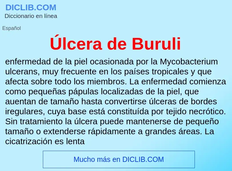 ¿Qué es Úlcera de Buruli? - significado y definición