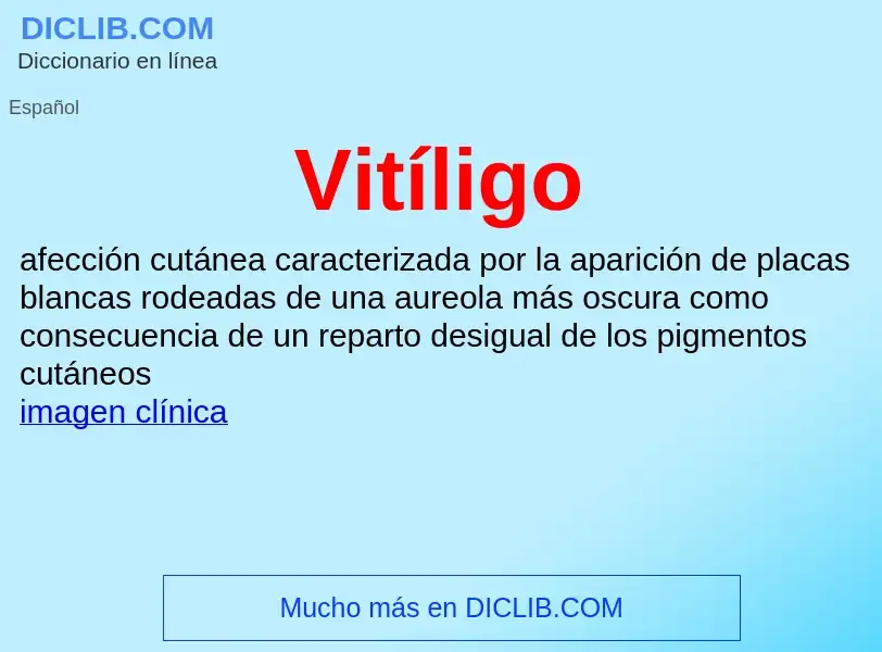 ¿Qué es Vitíligo? - significado y definición