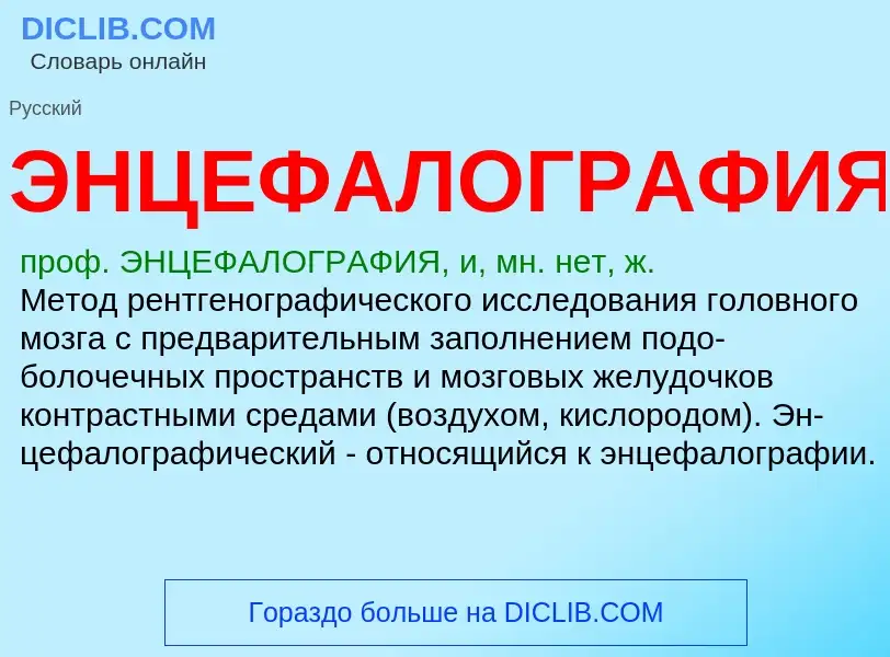 ¿Qué es ЭНЦЕФАЛОГРАФИЯ? - significado y definición