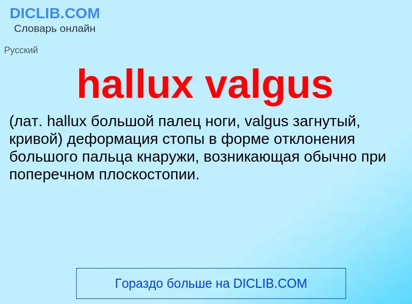 Что такое hallux valgus  - определение